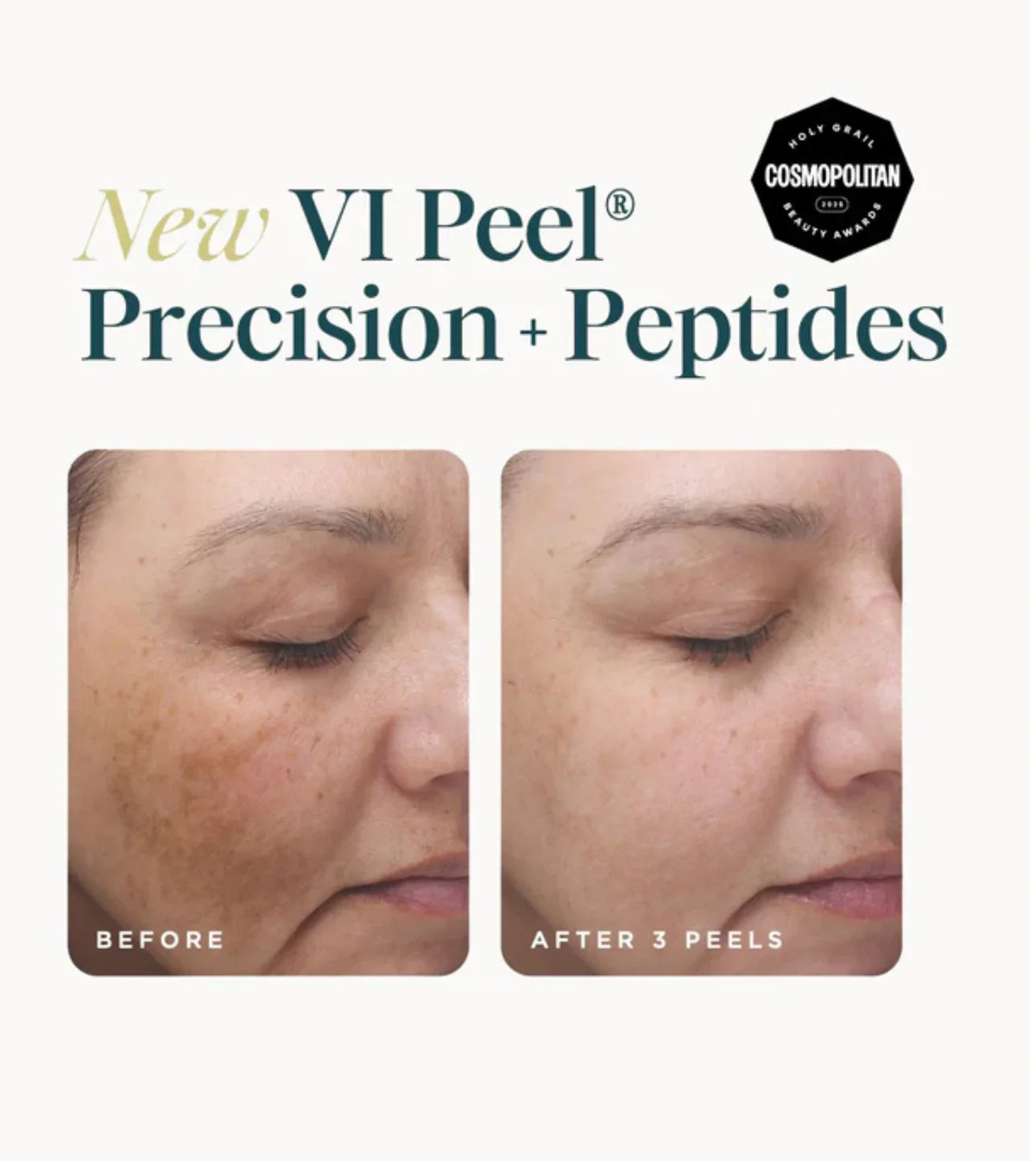 VI Peel Precision +peptides (Full Kit) Exp 01/2028 -Authentic
