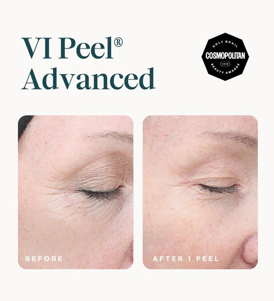 VI Peel Advanced (Full Kit) Exp 01/2028 -Authentic